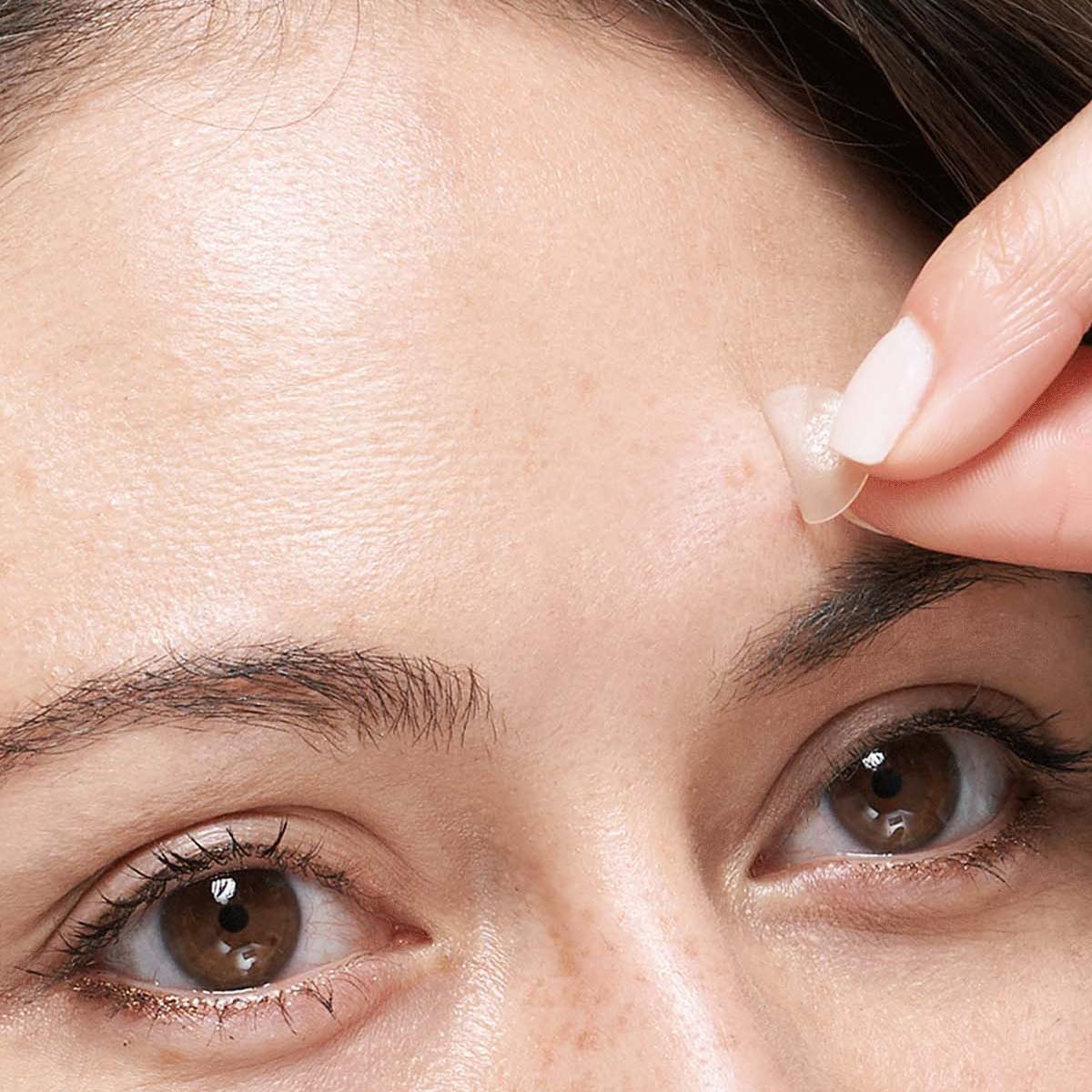 Mighty Patch vs COSRX Patches for Blackheads, Acne, Pimples, and Blemishes Seeking Derma